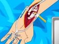 Lojë Arm surgery 2