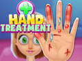 Lojë Hand Treatment