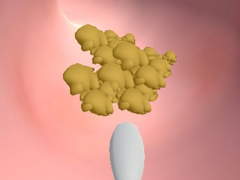 Lojë Earwax Clinic